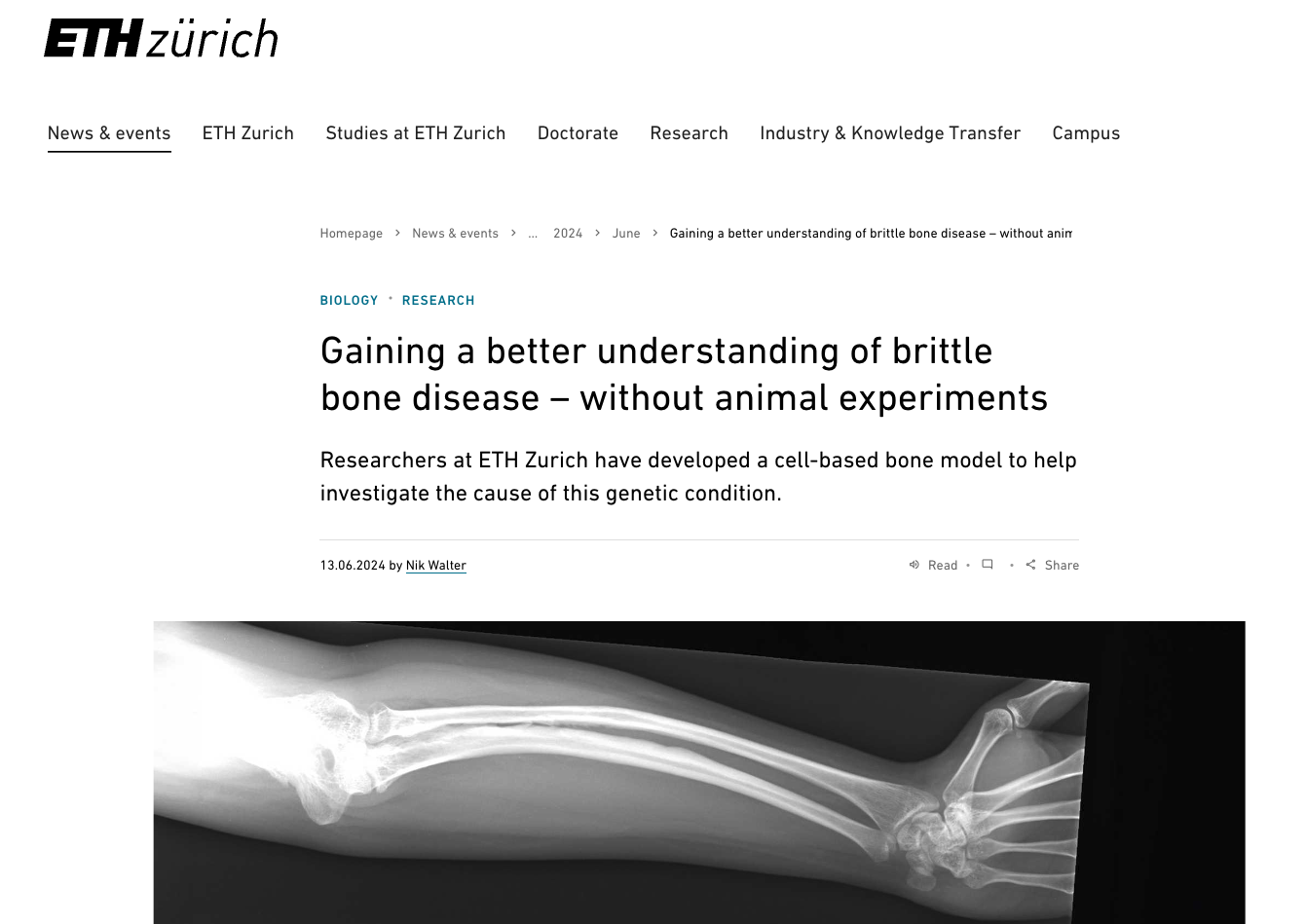 ETH-news-better-understand-brittle-bone-disease